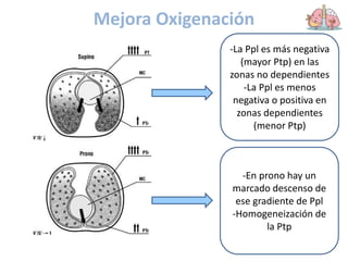Mejora Oxigenación
-La Ppl es más negativa
(mayor Ptp) en las
zonas no dependientes
-La Ppl es menos
negativa o positiva en
zonas dependientes
(menor Ptp)
-En prono hay un
marcado descenso de
ese gradiente de Ppl
-Homogeneización de
la Ptp
 