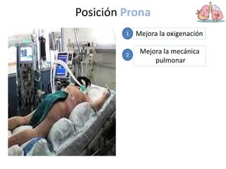 Posición Prona
Mejora la oxigenación
1
Mejora la mecánica
pulmonar
2
 