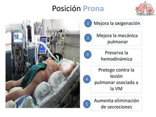 Posición Prona
Mejora la oxigenación
1
Mejora la mecánica
pulmonar
2
Preserva la
hemodinámica
3
Protege contra la
lesión
pulmonar asociada a
la VM
4
Aumenta eliminación
de secreciones
5
 