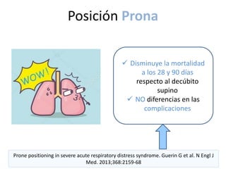 Prone positioning in severe acute respiratory distress syndrome. Guerin G et al. N Engl J
Med. 2013;368:2159-68
 Disminuye la mortalidad
a los 28 y 90 días
respecto al decúbito
supino
 NO diferencias en las
complicaciones
Posición Prona
 