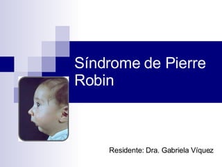 Síndrome de Pierre Robin Residente: Dra. Gabriela Víquez 
