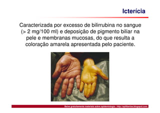 Síndrome, Febre, Icterícia e Hemorragia