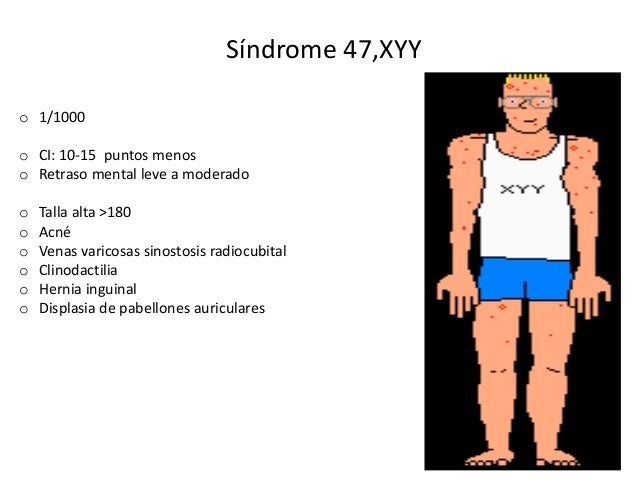 Síndrome 47 Xxx