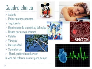 Cuadro clínico
Astenia
 Palidez cutaneo mucosa
 Taquicardia
 Disminución de la amplitud del pulso
 Disnea por anoxia anémica
 Cefalea
 Vértigos
 Inestabilidad
 Somnolencia
 Shock, pudiendo acabar con
la vida del enfermo en muy poco tiempo


 