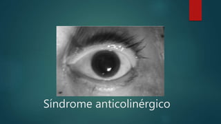 Síndrome anticolinérgico
 
