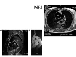 MRI
 