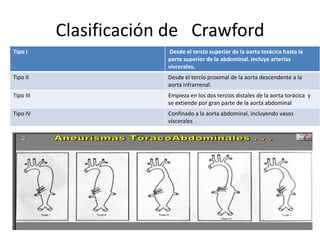 Clasificación de Crawford
Tipo I                  Desde el tercio superior de la aorta torácica hasta la
                        parte superior de la abdominal. Incluye arterias
                        viscerales.
Tipo II                 Desde el tercio proximal de la aorta descendente a la
                        aorta infrarrenal.
Tipo III                Empieza en los dos tercios distales de la aorta torácica y
                        se extiende por gran parte de la aorta abdominal
Tipo IV                 Confinado a la aorta abdominal, incluyendo vasos
                        viscerales
 