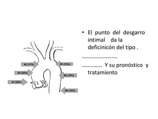 • El punto del desgarro
  intimal da la
  deficinicón del tipo .
…………………….
………….. Y su pronóstico y
  tratamiento
 