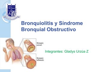 Bronquiolitis y Síndrome
Bronquial Obstructivo
Integrantes: Gladys Urzúa Z
 