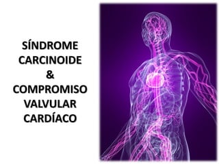 SÍNDROME
 CARCINOIDE
      &
COMPROMISO
  VALVULAR
  CARDÍACO
 