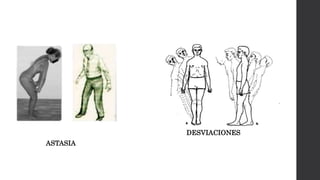 ASTASIA
DESVIACIONES
 