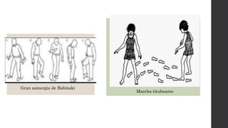 Gran asinergia de Babinski
Marcha titubeante
 