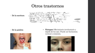 Otros trastornos
• De la escritura
• De la palabra
•
• Nistagmo: Movimiento involuntario y
rápido de los ojos. Puede ser horizontal,
vertical o rotatorio.
 