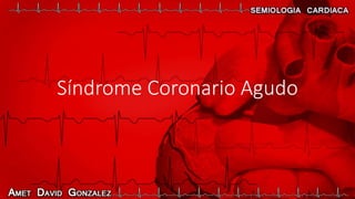 Síndrome Coronario Agudo
 