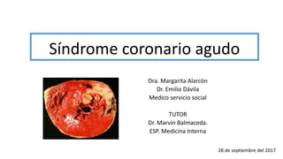 Síndrome coronario agudo
Dra. Margarita Alarcón
Dr. Emilio Dávila
Medico servicio social
TUTOR
Dr. Marvin Balmaceda.
ESP. Medicina Interna
28 de septiembre del 2017
 