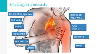 Infarto agudo al miocardio
Dolor de tipo opresivo
Diaforesis
Disnea
Taquicardia
Hipotensión
Cefalea
palidez de
tegumento
Pulso
irregular
Lipotimia
Mareo
 