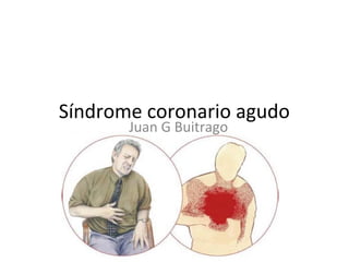Síndrome coronario agudo
Juan G Buitrago
 