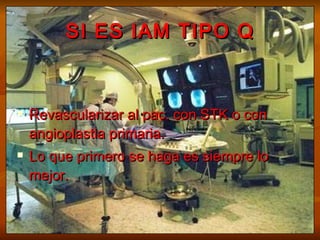 SI ES IAM TIPO Q Revascularizar al pac. con STK o con angioplastia primaria.  Lo que primero se haga es siempre lo mejor.  