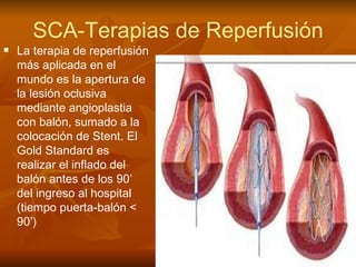La terapia de reperfusión más aplicada en el mundo es la apertura de la lesión oclusiva mediante angioplastia con balón, sumado a la colocación de Stent. El Gold Standard es realizar el inflado del balón antes de los 90’ del ingreso al hospital (tiempo puerta-balón < 90’) SCA-Terapias de Reperfusión 