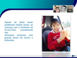 Apesar de todos esses
problemas citados acima, as
crianças com a síndrome de
Cri-du-Chat, normalmente
são
amorosas, sociáveis, com
grande senso de humor e
brilhantes.
 