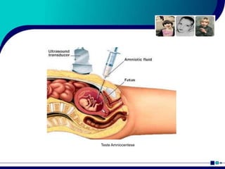 Teste Amniocentese
 