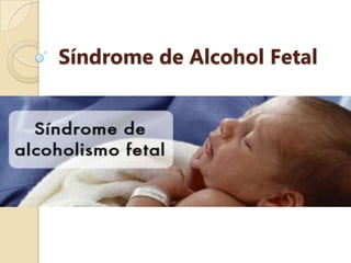 Síndrome de Alcohol Fetal 