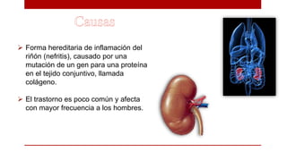  Forma hereditaria de inflamación del
riñón (nefritis), causado por una
mutación de un gen para una proteína
en el tejido conjuntivo, llamada
colágeno.
 El trastorno es poco común y afecta
con mayor frecuencia a los hombres.
 