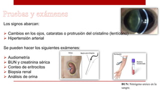 Los signos abarcan:
 Cambios en los ojos, cataratas o protrusión del cristalino (lentícono)
 Hipertensión arterial
Se pueden hacer los siguientes exámenes:
 Audiometría
 BUN y creatinina sérica
 Conteo de eritrocitos
 Biopsia renal
 Análisis de orina
BUN: Nitrógeno ureico en la
sangre.
 