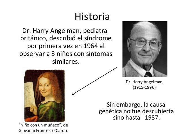 pix Dr Harry Angelman sindrome de angelman