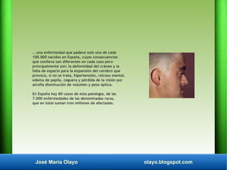 José María Olayo olayo.blogspot.com
… una enfermedad que padece solo uno de cada
100.000 nacidos en España, cuyas consecue...