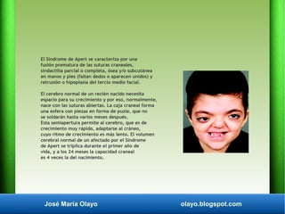 José María Olayo olayo.blogspot.com
El Síndrome de Apert se caracteriza por una
fusión prematura de las suturas craneales,...