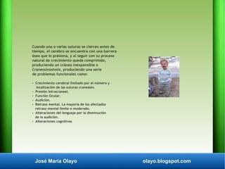 José María Olayo olayo.blogspot.com
Cuando una o varias suturas se cierran antes de
tiempo, el cerebro se encuentra con un...