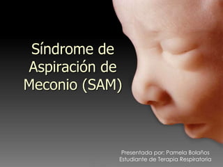 Síndrome de Aspiración de Meconio (SAM) Presentada por: Pamela Bolaños Estudiante de Terapia Respiratoria 