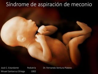 Síndrome de aspiración de meconio
José C. Estardante Pediatría Dr. Fernando Ventura Platero
Misael Santacruz Ortega 1002
 