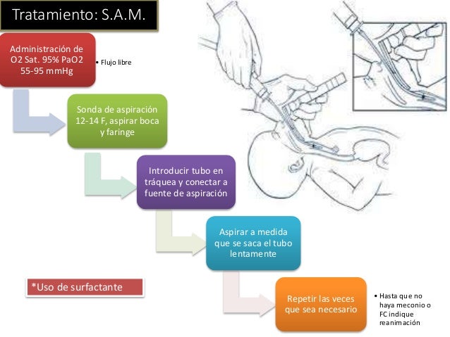 Síndrome de aspiracion de meconio