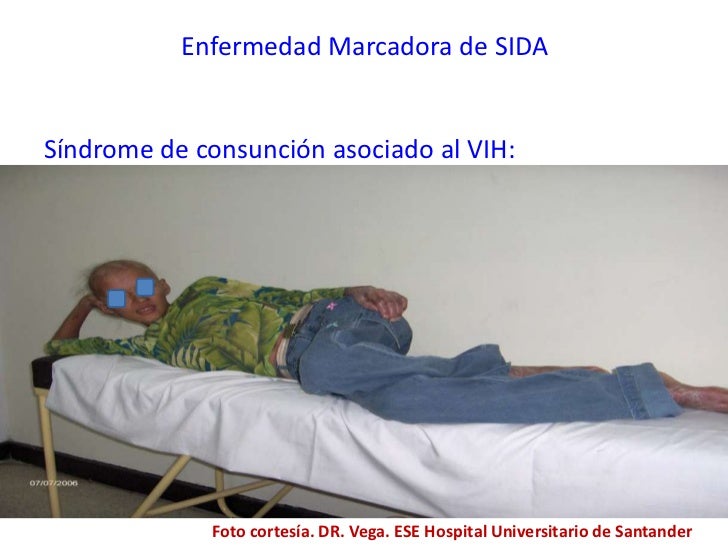 Sindrome de Consunción. Agustín Vega Vera