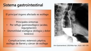 Sistema gastrointestinal
El principal órgano afectado es esófago
Principales síntomas
• Por reflujo gastroesofágico (acidez,
regurgitación)
• Dismotilidad esofágica (disfagia y dolor
torácico)
Complicaciones: estenosis péptica,
esófago de Barret y cáncer de esófago
Ann Gastroenterol. 2018 Mar-Apr; 31(2): 165–170.
 