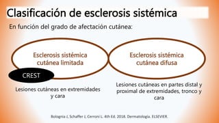 Clasificación de esclerosis sistémica
En función del grado de afectación cutánea:
Esclerosis sistémica
cutánea limitada
Esclerosis sistémica
cutánea difusa
Lesiones cutáneas en partes distal y
proximal de extremidades, tronco y
cara
Lesiones cutáneas en extremidades
y cara
CREST
Bolognia J, Schaffer J, Cerroni L. 4th Ed. 2018. Dermatología. ELSEVIER.
 