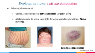 ● Pele e tecido conjuntivo
○ Degradação do colágeno: estrias violáceas largas (> 1 cm)
○ Adelgaçamento da pele e exposição do tecido vascular subcutâneo: fácies
pletórica
Depleção proteica : alto valor discriminatório
MELMED et al., 2016
Equimoses espontâneas
 