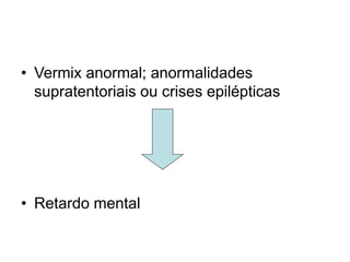 • Vermix anormal; anormalidades 
supratentoriais ou crises epilépticas 
• Retardo mental 
 