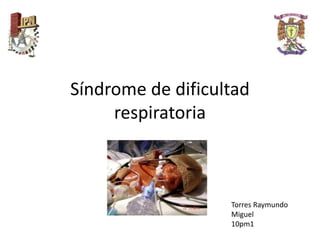 Síndrome de dificultad
respiratoria
Torres Raymundo
Miguel
10pm1
 