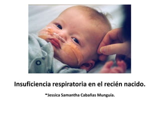 Insuficiencia respiratoria en el recién nacido.

-Jessica Samantha Cabañas Munguía.

 