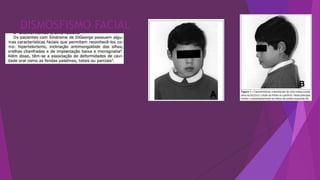 DISMOSFISMO FACIAL
 