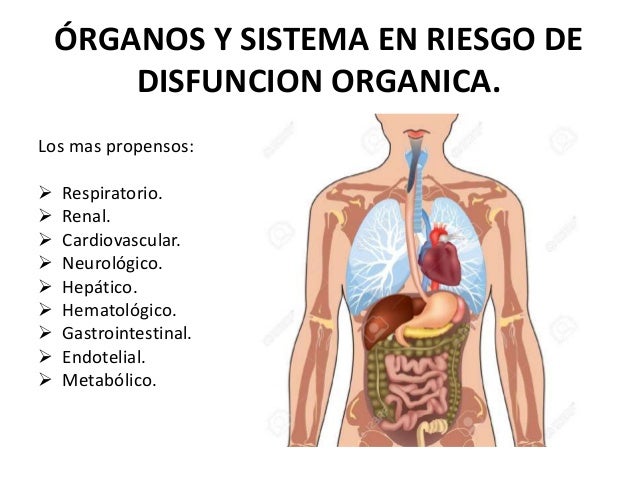 Síndrome de disfunción orgánica múltiple
