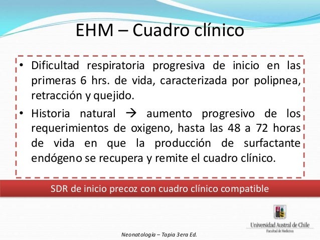 Síndrome de Dificultad Respiratoria (SDR) Neonatal