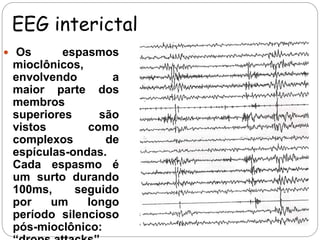 EEG interictal 
 Os espasmos 
mioclônicos, 
envolvendo a 
maior parte dos 
membros 
superiores são 
vistos como 
complexos de 
espículas-ondas. 
Cada espasmo é 
um surto durando 
100ms, seguido 
por um longo 
período silencioso 
pós-mioclônico: 
“drops attacks” 
 