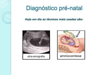 Diagnóstico pré-natal
Hoje em dia as técnicas mais usadas são:
 