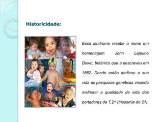 Historicidade:



                 Essa síndrome recebe o nome em

                 homenagem         John       Lejeune

                 Down, britânico que a descreveu em

                 1862. Desde então dedicou a sua

                 vida as pesquisas genéticas visando

                 melhorar a qualidade de vida dos

                 portadores da T.21 (trissomia do 21).
 