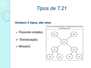 Tipos de T.21

Existem 3 tipos, são eles:


 Trissomia   simples;

 Translocação;

 Mosaico;
 