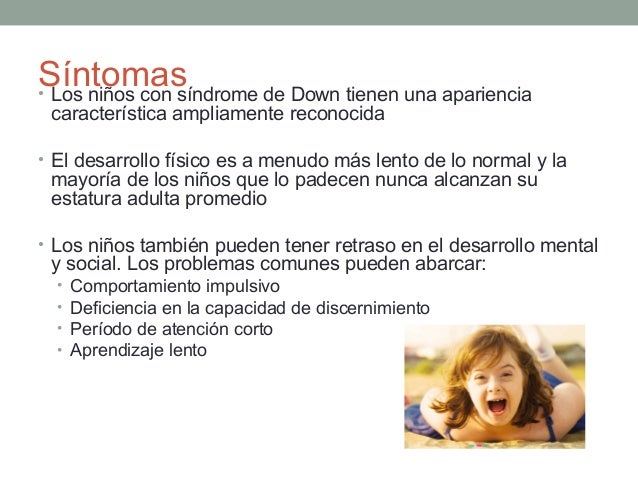 Síndrome de down